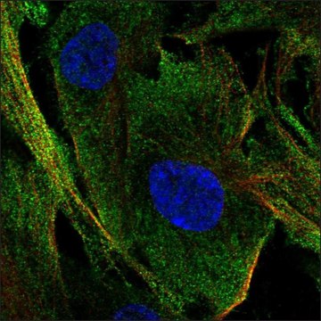 Anti-C1orf54 antibody produced in rabbit Prestige Antibodies&#174; Powered by Atlas Antibodies, affinity isolated antibody