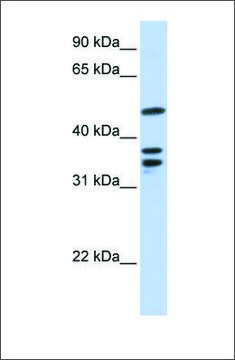 Anti-ETV6 (ab1) antibody produced in rabbit affinity isolated antibody