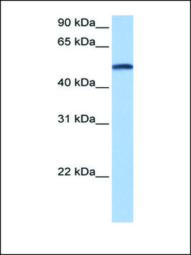 Anti-CYP1B1 antibody produced in rabbit affinity isolated antibody