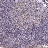 Anti-CELF5 antibody produced in rabbit Prestige Antibodies® Powered by Atlas Antibodies, affinity isolated antibody, buffered aqueous glycerol solution