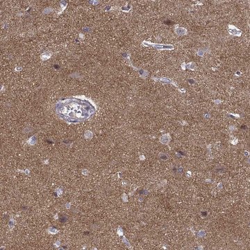 Anti-STRC antibody produced in rabbit Prestige Antibodies&#174; Powered by Atlas Antibodies, affinity isolated antibody