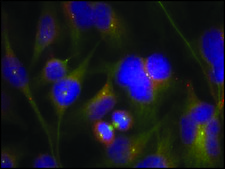 Anti-PTK2 (Ab-925) antibody produced in rabbit affinity isolated antibody