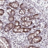 Anti-ZFHX3 antibody produced in rabbit Prestige Antibodies® Powered by Atlas Antibodies, affinity isolated antibody, buffered aqueous glycerol solution