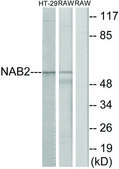 Anti-NAB2 antibody produced in rabbit affinity isolated antibody