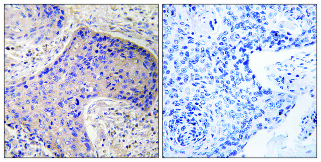 Anti-ST6GAL1 antibody produced in rabbit affinity isolated antibody