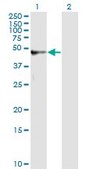 Monoclonal Anti-AMBP antibody produced in mouse clone 3F1, purified immunoglobulin, buffered aqueous solution