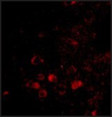 Anti-ELOVL6 antibody produced in rabbit affinity isolated antibody, buffered aqueous solution