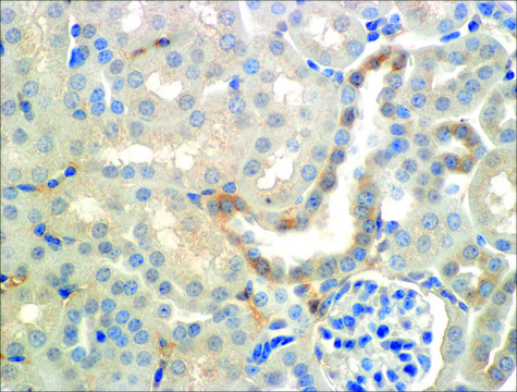 Monoclonal Anti-ENaC beta antibody produced in mouse clone 7B8