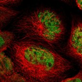 Anti-NFRKB antibody produced in rabbit Ab2, Prestige Antibodies® Powered by Atlas Antibodies, affinity isolated antibody, buffered aqueous glycerol solution