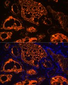 Anti-Thyroglobulin Antibody, clone 3I10H1, Rabbit Monoclonal