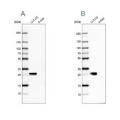 Anti-CT45A1 antibody produced in rabbit Prestige Antibodies® Powered by Atlas Antibodies, affinity isolated antibody, buffered aqueous glycerol solution