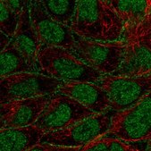 Anti-FOXN3 antibody produced in rabbit Prestige Antibodies® Powered by Atlas Antibodies, affinity isolated antibody, buffered aqueous glycerol solution