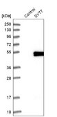 Anti-SYT7 antibody produced in rabbit Prestige Antibodies® Powered by Atlas Antibodies, affinity isolated antibody, buffered aqueous glycerol solution