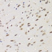 Anti-BAZ1B antibody produced in rabbit