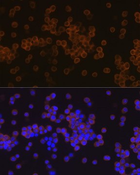 Anti-PLC gamma 2 (PLCG2) Antibody, clone 7I1C9, Rabbit Monoclonal