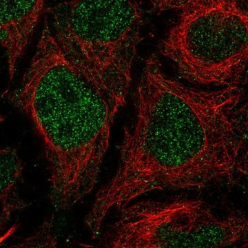 Anti-TMEM8A antibody produced in rabbit Prestige Antibodies&#174; Powered by Atlas Antibodies, affinity isolated antibody