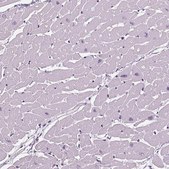 Anti-TNNC2 antibody produced in rabbit Prestige Antibodies® Powered by Atlas Antibodies, affinity isolated antibody, buffered aqueous glycerol solution