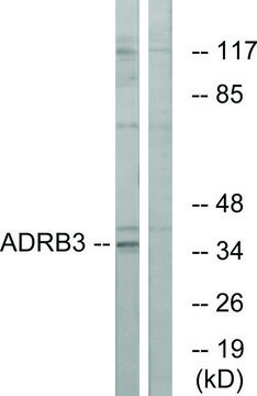 抗 ADRB3 兔抗 affinity isolated antibody