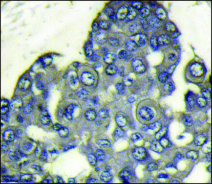 Anti-PI3KCD (N-term) antibody produced in rabbit IgG fraction of antiserum, buffered aqueous solution