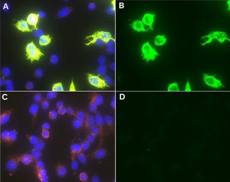 Anti-Measles Antibody, nucleoprotein, clone 83KKII clone 83KKII, Chemicon&#174;, from mouse