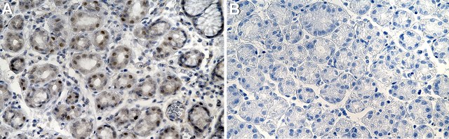 Anti-KLF2 Antibody, clone 1C3 ZooMAb&#174; Rabbit Monoclonal recombinant, expressed in HEK 293 cells