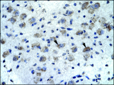 Anti-KCNH5 (AB1) antibody produced in rabbit affinity isolated antibody