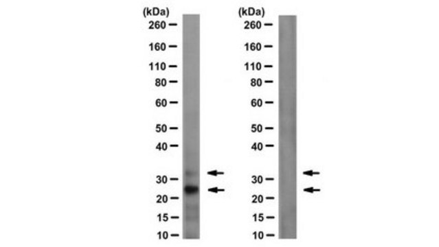 Anti-H2AK15ub Antibody, clone EDL H2AK15-4 clone EDL H2AK15-4, from mouse