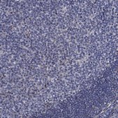 Anti-TTBK1 antibody produced in rabbit Prestige Antibodies® Powered by Atlas Antibodies, affinity isolated antibody, buffered aqueous glycerol solution