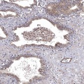 Anti-WDR19 antibody produced in rabbit Prestige Antibodies® Powered by Atlas Antibodies, affinity isolated antibody, buffered aqueous glycerol solution