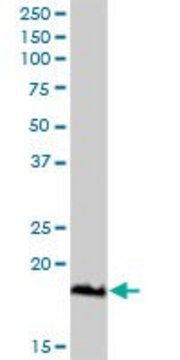 Anti-TNFRSF13C antibody produced in rabbit purified immunoglobulin, buffered aqueous solution