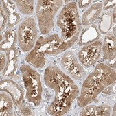 Anti-INPP4B antibody produced in rabbit Prestige Antibodies® Powered by Atlas Antibodies, affinity isolated antibody, buffered aqueous glycerol solution