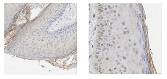 Anti-Kallikrein-5 Antibody/KLK5 from rabbit, purified by affinity chromatography