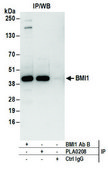 Rabbit anti-BMI1 Antibody, Affinity Purified Powered by Bethyl Laboratories, Inc.