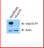 Anti-Cep152 (P7) from rabbit, purified by affinity chromatography