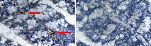 Anti-MAdCAM-1 Antibody, clone MECA-89