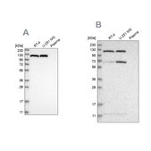 Anti-ACLY antibody produced in rabbit Prestige Antibodies® Powered by Atlas Antibodies, affinity isolated antibody, buffered aqueous glycerol solution, Ab1