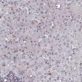 Anti-RABGAP1 antibody produced in rabbit Prestige Antibodies® Powered by Atlas Antibodies, affinity isolated antibody