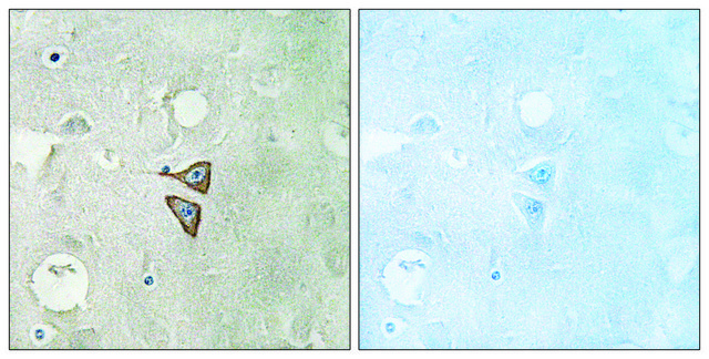 Anti-Opioid Receptor-&#948; antibody produced in rabbit affinity isolated antibody