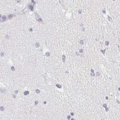 Anti-ACAN antibody produced in rabbit Prestige Antibodies® Powered by Atlas Antibodies, affinity isolated antibody