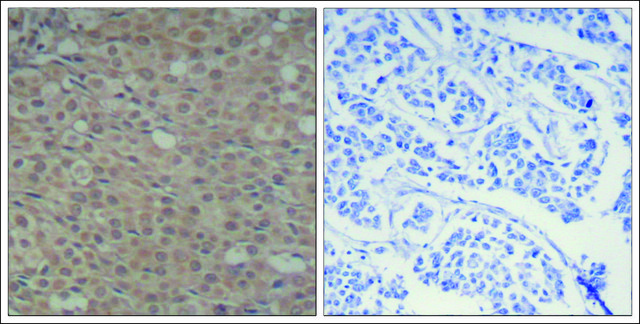 Anti-phospho-SMAD3 (pSer425) antibody produced in rabbit affinity isolated antibody