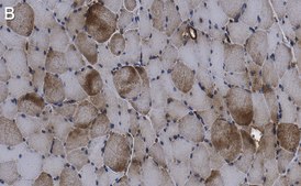 Anti-LEAP2 Antibody, clone 1D17 ZooMAb® Rabbit Monoclonal recombinant, expressed in HEK 293 cells