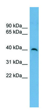 Anti-SUV39H2 antibody produced in rabbit affinity isolated antibody