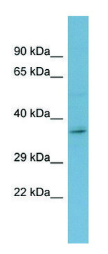 Anti-GHR (C-terminal) antibody produced in rabbit affinity isolated antibody