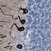 Anti-ITPR1 antibody produced in rabbit Prestige Antibodies® Powered by Atlas Antibodies, affinity isolated antibody, buffered aqueous glycerol solution