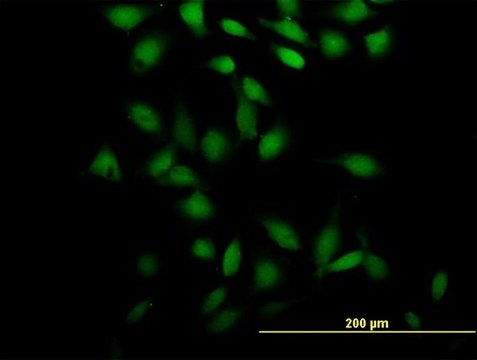 Anti-CCDC131 antibody produced in mouse purified immunoglobulin, buffered aqueous solution