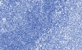 Anti-Fyn Antibody, clone 2F15 ZooMAb® Rabbit Monoclonal recombinant, expressed in HEK 293 cells