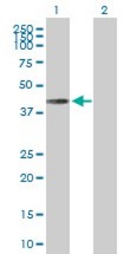 Anti-CAMK1D antibody produced in rabbit purified immunoglobulin, buffered aqueous solution