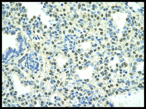 Anti-PATZ1 antibody produced in rabbit affinity isolated antibody