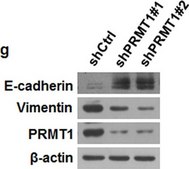 Anti-PRMT1 Antibody Upstate®, from rabbit