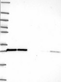 Anti-EIF4E antibody produced in rabbit Prestige Antibodies® Powered by Atlas Antibodies, affinity isolated antibody, buffered aqueous glycerol solution